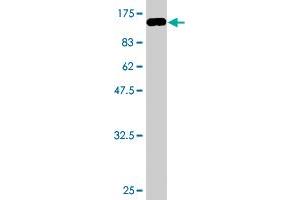 Western Blot detection against Immunogen (93. (PRC1 antibody  (AA 1-620))