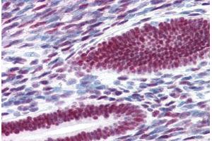 Human Uterus (formalin-fixed, paraffin-embedded) stained with ESR1 antibody ABIN337383 at 10 ug/ml followed by biotinylated goat anti-rabbit IgG secondary antibody ABIN481713, alkaline phosphatase-streptavidin and chromogen. (Estrogen Receptor alpha antibody  (C-Term))