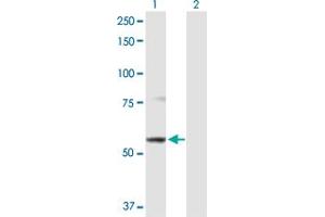 Western Blotting (WB) image for anti-ATP-Binding Cassette, Sub-Family B (MDR/TAP), Member 9 (ABCB9) (AA 1-596) antibody (ABIN525182)