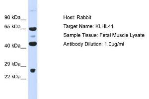 Host: Rabbit Target Name: KLHL41 Sample Type: Fetal Muscle lysates Antibody Dilution: 1. (Kelch-like protein 41 (KLHL41) (Middle Region) antibody)