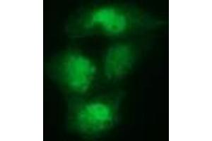 Anti-SPR mouse monoclonal antibody (ABIN2453681) immunofluorescent staining of COS7 cells transiently transfected by pCMV6-ENTRY SPR (RC205679). (SPR antibody)