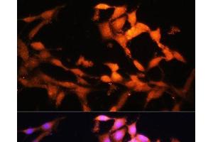 Immunofluorescence analysis of NIH/3T3 cells using FLCN Polyclonal Antibody at dilution of 1:100. (FLCN antibody)