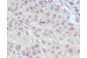 Immunohistochemistry (IHC) image for anti-Myeloid/lymphoid Or Mixed-Lineage Leukemia (MLL) (AA 3751-3968) antibody (ABIN2464083) (MLL/KMT2A antibody  (AA 3751-3968))