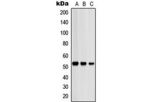 Western blot analysis of PRKAR2B expression in HeLa (A), SHSY5Y (B), NIH3T3 (C) whole cell lysates. (PRKAR2B antibody  (Center))