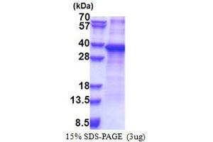RPS2 Protein (AA 1-293) (His tag)