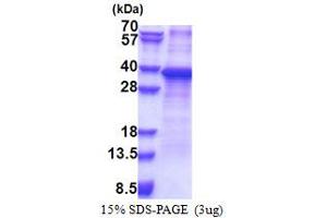 SDS-PAGE (SDS) image for Ribosomal Protein S2 (RPS2) (AA 1-293) protein (His tag) (ABIN5853321) (RPS2 Protein (AA 1-293) (His tag))