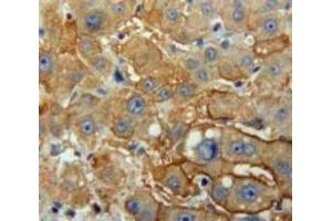Used in DAB staining on fromalin fixed paraffin-embedded Liver tissue (PNLIP antibody  (AA 201-412))