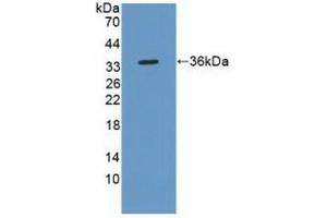 Detection of Recombinant ROS1, Human using Polyclonal Antibody to C-Ros Oncogene 1, Receptor Tyrosine Kinase (ROS1) (ROS1 antibody  (AA 1945-2222))