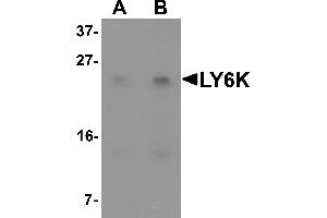 Western blot analysis of LY6K in HeLa cell lysate with LY6K antibody at (A) 1 and (B) 2 µg/mL. (Ly6k antibody  (N-Term))