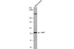WB Image HHIP antibody [N3C2], Internal detects HHIP protein by western blot analysis.