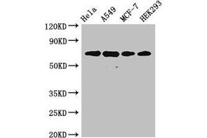 Western Blot Positive WB detected in: Hela whole cell lysate, A549 whole cell lysate, MCF-7 whole cell lysate, HEK293 whole cell lysate All lanes: XRCC6 antibody at 4 μg/mL Secondary Goat polyclonal to rabbit IgG at 1/50000 dilution Predicted band size: 70, 66 kDa Observed band size: 70 kDa (XRCC6 antibody  (AA 2-609))