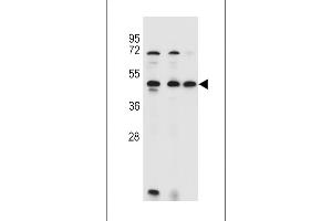 ANKRD40 Antibody (C-term) (ABIN655309 and ABIN2844891) western blot analysis in 293,HL-60,MCF-7 cell line lysates (35 μg/lane). (ANKRD40 antibody  (C-Term))