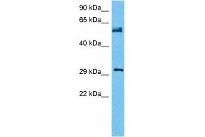 Host:  Mouse  Target Name:  NFIA  Sample Tissue:  Mouse Testis  Antibody Dilution:  1ug/ml (NFIA antibody  (Middle Region))