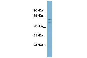 WB Suggested Anti-ATP6V1B1 Antibody Titration: 0. (ATP6V1B1 antibody  (Middle Region))