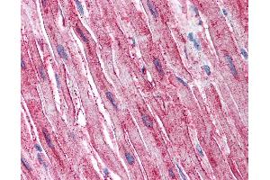 Immunohistochemistry (IHC) image for anti-ADAM Metallopeptidase with Thrombospondin Type 1 Motif, 4 (ADAMTS4) (Internal Region) antibody (ABIN625840)