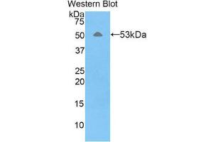 Western Blotting (WB) image for anti-Fibrous Sheath Interacting Protein 1 (FSIP1) (AA 109-328) antibody (ABIN1858923) (FSIP1 antibody  (AA 109-328))