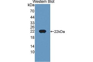 Figure. (CTAG1B antibody  (AA 1-180))