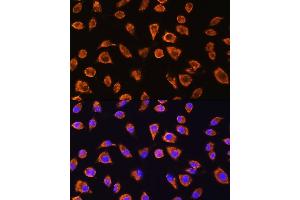 Immunofluorescence analysis of L929 cells using NOTCH4 Rabbit pAb (ABIN6132420, ABIN6144740, ABIN6144741 and ABIN6224315) at dilution of 1:100. (NOTCH4 antibody  (AA 1824-2003))