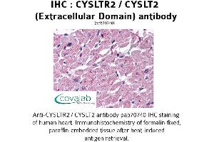 Image no. 1 for anti-Cysteinyl Leukotriene Receptor 2 (CYSLTR2) (1st Extracellular Domain) antibody (ABIN1733462)