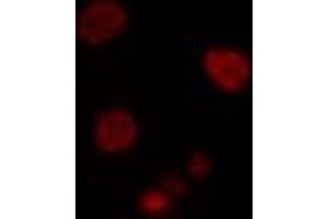 ABIN6274502 staining Hela cells by IF/ICC. (PBOV1 antibody  (Internal Region))
