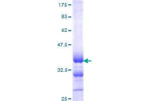Image no. 1 for Calcitonin-Related Polypeptide alpha (CALCA) (AA 52-141) protein (GST tag) (ABIN1347867) (CGRP Protein (AA 52-141) (GST tag))