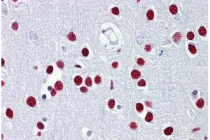 Anti-TUB antibody IHC staining of human brain, cortex. (TUB antibody  (AA 144-193))