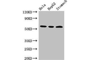 Western Blot Positive WB detected in: Hela whole cell lysate, HepG2 whole cell lysate, Mouse stomach tissue All lanes: MDM4 antibody at 3 μg/mL Secondary Goat polyclonal to rabbit IgG at 1/50000 dilution Predicted band size: 55, 15, 14, 19, 50 kDa Observed band size: 55 kDa (MDM4-binding Protein antibody  (AA 208-306))