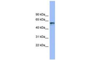 Image no. 1 for anti-Interleukin 18 Receptor 1 (IL18R1) (AA 35-84) antibody (ABIN6743248) (IL18R1 antibody  (AA 35-84))