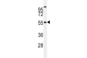 BMP4 antibody western blot analysis in MDA-MB435 lysate. (BMP4 antibody  (AA 5-34))