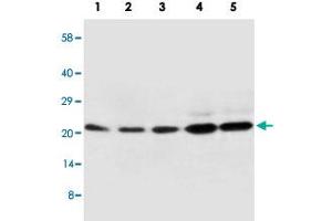 Western blot analysis of tissue and whole cell extracts with CDC42 polyclonal antibody . (CDC42 antibody  (Internal Region))