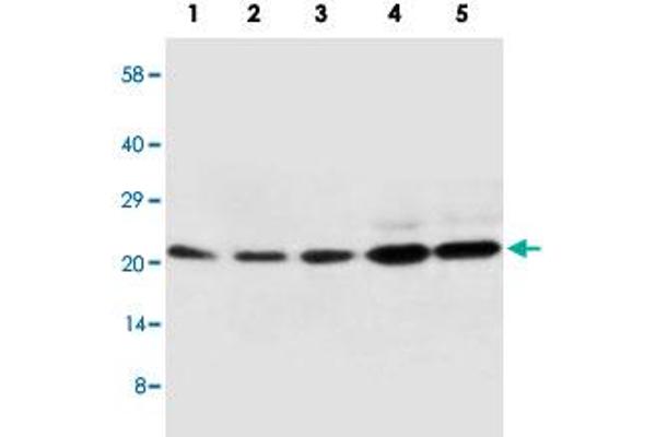 CDC42 antibody  (Internal Region)