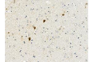 APP Mouse Monoclonal Antibody at 1/100 staining rat brain tissue by IHC-P. (APP antibody  (C-Term))