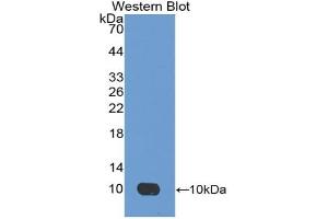 Western blot analysis of the recombinant protein. (Apelin antibody  (AA 24-77))