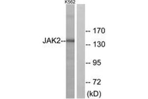 Western blot analysis of extracts from K562 cells, using JAK2 (Ab-221) Antibody. (JAK2 antibody  (AA 191-240))