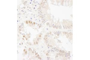 Immunohistochemistry (IHC) image for anti-Budding Uninhibited By Benzimidazoles 1 Homolog (Yeast) (BUB1) (AA 1-50) antibody (ABIN7454620) (BUB1 antibody  (AA 1-50))