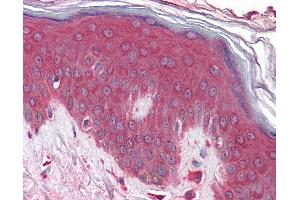 Anti-KLHL23 antibody IHC of human skin. (KLHL23 antibody  (AA 432-481))