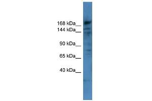 WB Suggested Anti-COL4A6 Antibody Titration: 0. (COL4a6 antibody  (Middle Region))