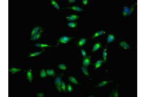 Immunofluorescent analysis of Hela cells using ABIN7172594 at dilution of 1:100 and Alexa Fluor 488-congugated AffiniPure Goat Anti-Rabbit IgG(H+L) (RELB antibody  (AA 400-579))