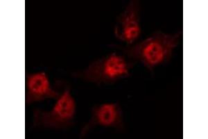ABIN6274101 staining HuvEc by IF/ICC. (ANP32C antibody  (Internal Region))