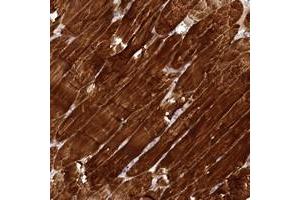 Immunohistochemical staining of human skeletal muscle with SYNPO2 polyclonal antibody  shows strong cytoplasmic positivity in myocytes at 1:500-1:1000 dilution. (SYNPO2 antibody)