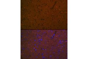 Immunofluorescence analysis of rat brain using 5HT7 Receptor Rabbit mAb (ABIN7265341) at dilution of 1:100 (40x lens). (HTR7 antibody)