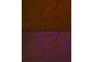 Immunofluorescence analysis of rat brain using 5HT7 Receptor Rabbit mAb (ABIN7265341) at dilution of 1:100 (40x lens). (HTR7 antibody)