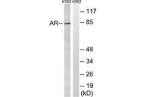 Western Blotting (WB) image for anti-Androgen Receptor (AR) (AA 331-380) antibody (ABIN2889124) (Androgen Receptor antibody  (AA 331-380))