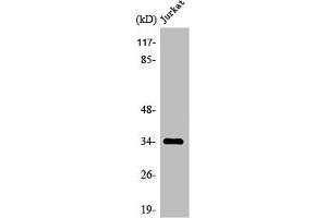 Western Blot analysis of Jurkat cells using Olfactory receptor 4C12 Polyclonal Antibody (OR4C12 antibody  (C-Term))