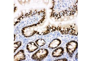 Anti-CTBP2 antibody, IHC(F) IHC(F): Rat Intestine Tissue