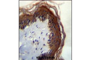 LI Antibdy (C-term) (ABIN656461 and ABIN2845745) immunohistochemistry analysis in formalin fixed and paraffin embedded human skin tissue followed by peroxidase conjugation of the secondary antibody and DAB staining. (LIPM antibody  (C-Term))