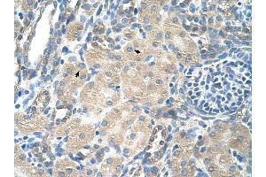 SLC13A3 antibody was used for immunohistochemistry at a concentration of 4-8 ug/ml to stain Epithelial cells of renal tubule (arrows) in Human Kidney. (SLC13A3 antibody)