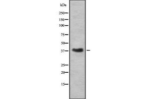 Western blot analysis of RNLS using A549 whole cell lysates (RNLS antibody  (C-Term))