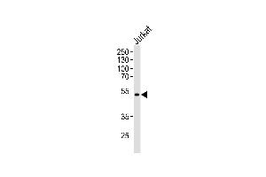 Western blot analysis of lysates from Jurkat cell line ,using K Antibody (ABIN484313 and ABIN1533694).