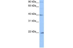 WB Suggested Anti-C4orf33 Antibody Titration: 0. (C4orf33 antibody  (C-Term))